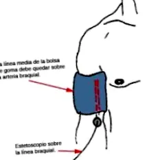 предотвратяване