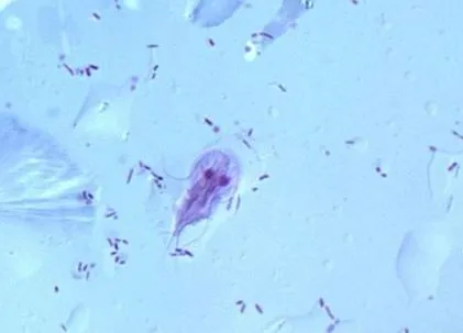 giardia