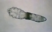 demodex