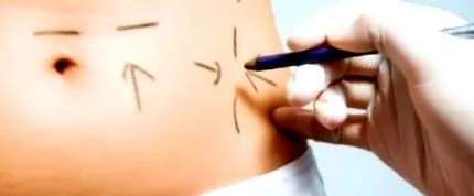 дієта