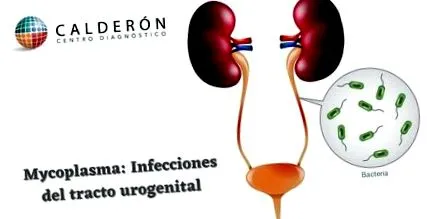 mycoplasma