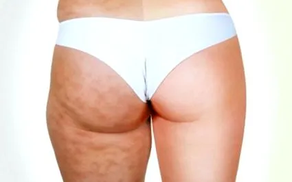 zsír