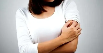 urticaria