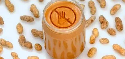allergia általában