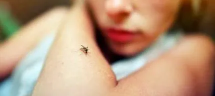 leishmaniasis