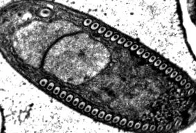 microsporidia