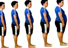 2-es típusú diabetes