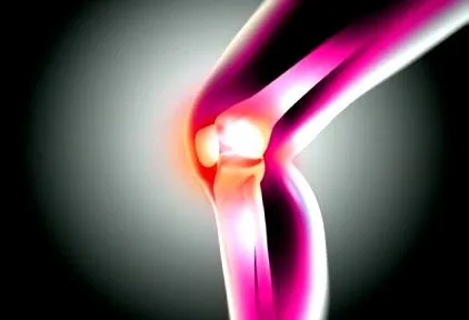 osteoarthritis