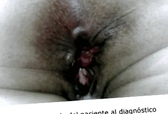 пациент
