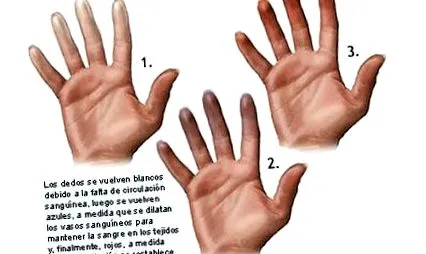 hogyan
