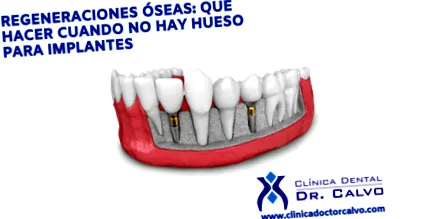 regeneráció