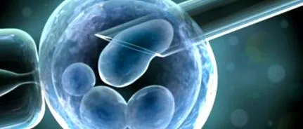 PCOS-ban szenvedő nőknél