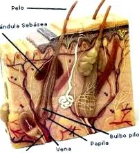 hipertermia