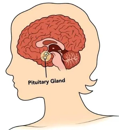 mirigy