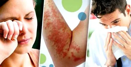 atópiás dermatitis