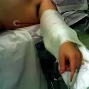 bariatrikus