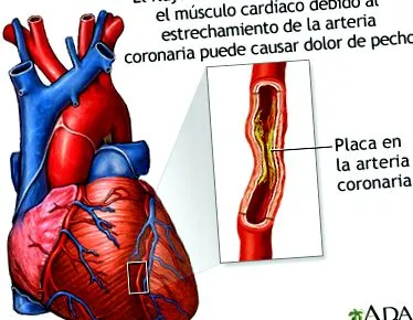 medlineplus
