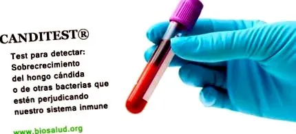 candidiasis