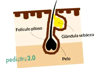 pattanások