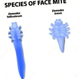 Demodex folliculorum