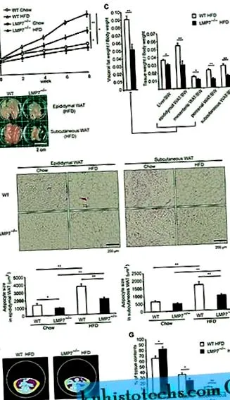 immunproteasomális