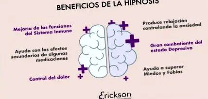 hipnózis