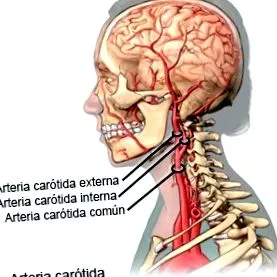 tida