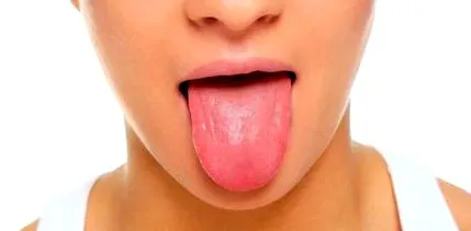 dental