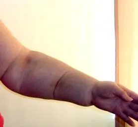отстраняване