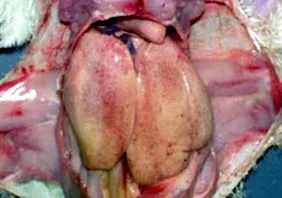 hepatitis