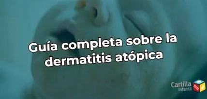 atópiás
