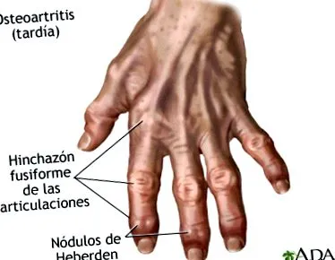 medlineplus
