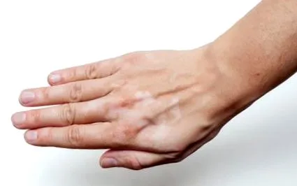 foltok