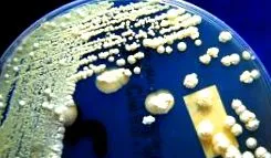 candidiasis