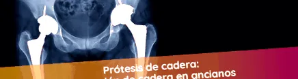 csípőműtét