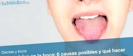 сладък