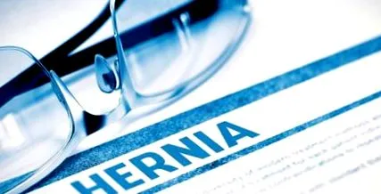 hiatal sérv