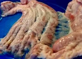 копчета