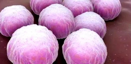 Bacillus cereus