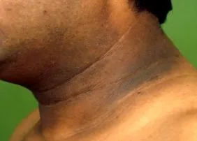 петна