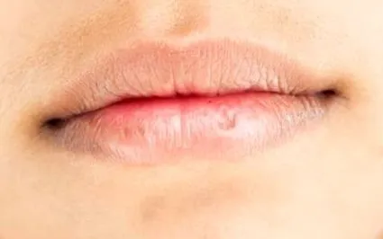 устни
