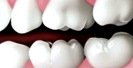 dental