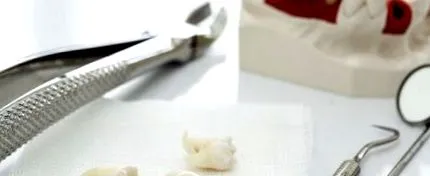 алвеолит