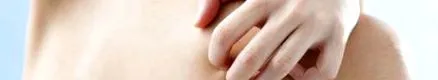 atópiás dermatitis