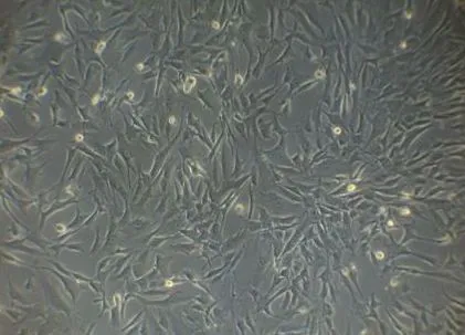 stromalis
