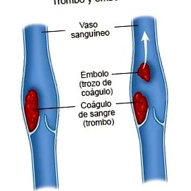 vénás