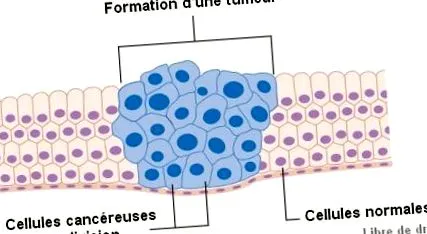 cancerele