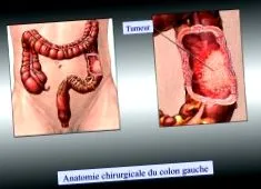 ABCD Chirurgie