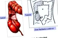 chirurgie
