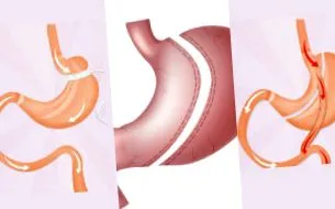 хірургія